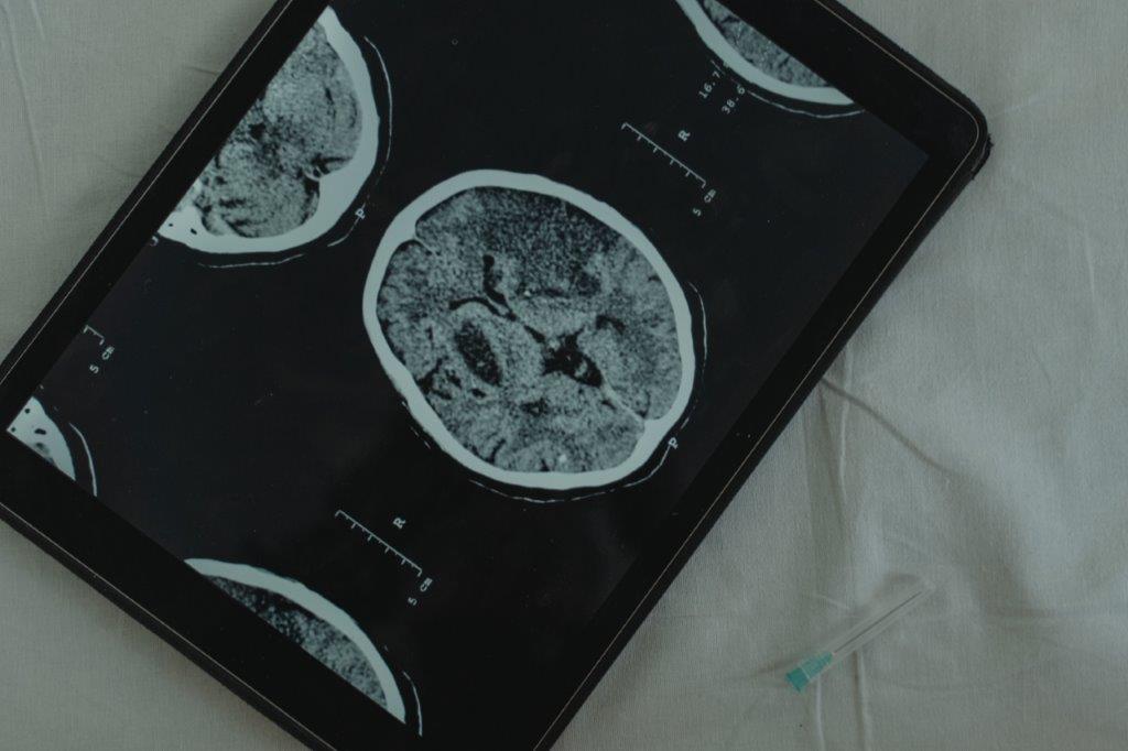 Tablet transmitting a CT scan"